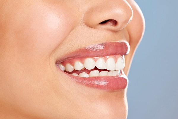 Reasons To Consider Zoom Teeth Whitening